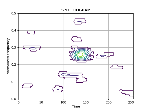 ../_images/plot_1_3_3_transient_spectrogram.png